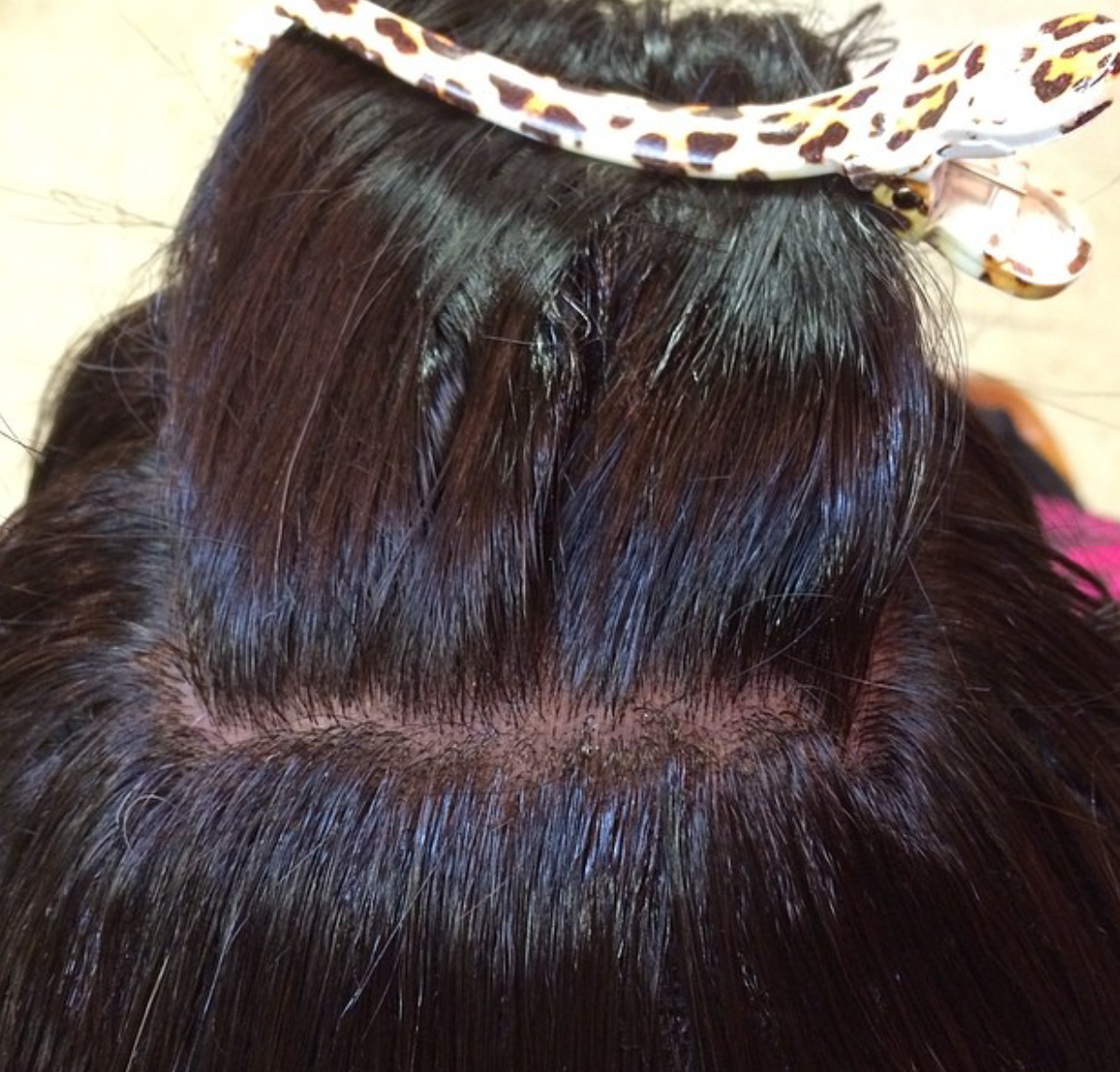 Silk Base Closure